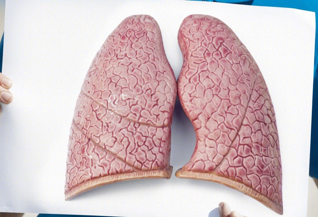 肺钙化是什么意思？