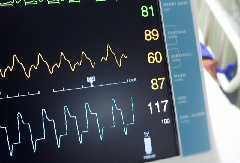 体检心电图正常，猝死前心电图还正常，心电图怎么了？