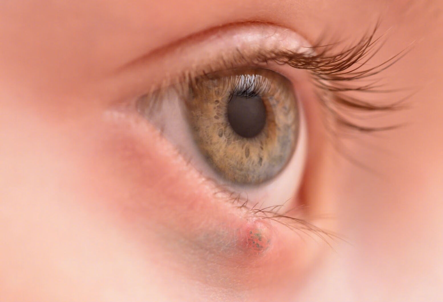 眼睛疼眼袋肿是怎么回事？