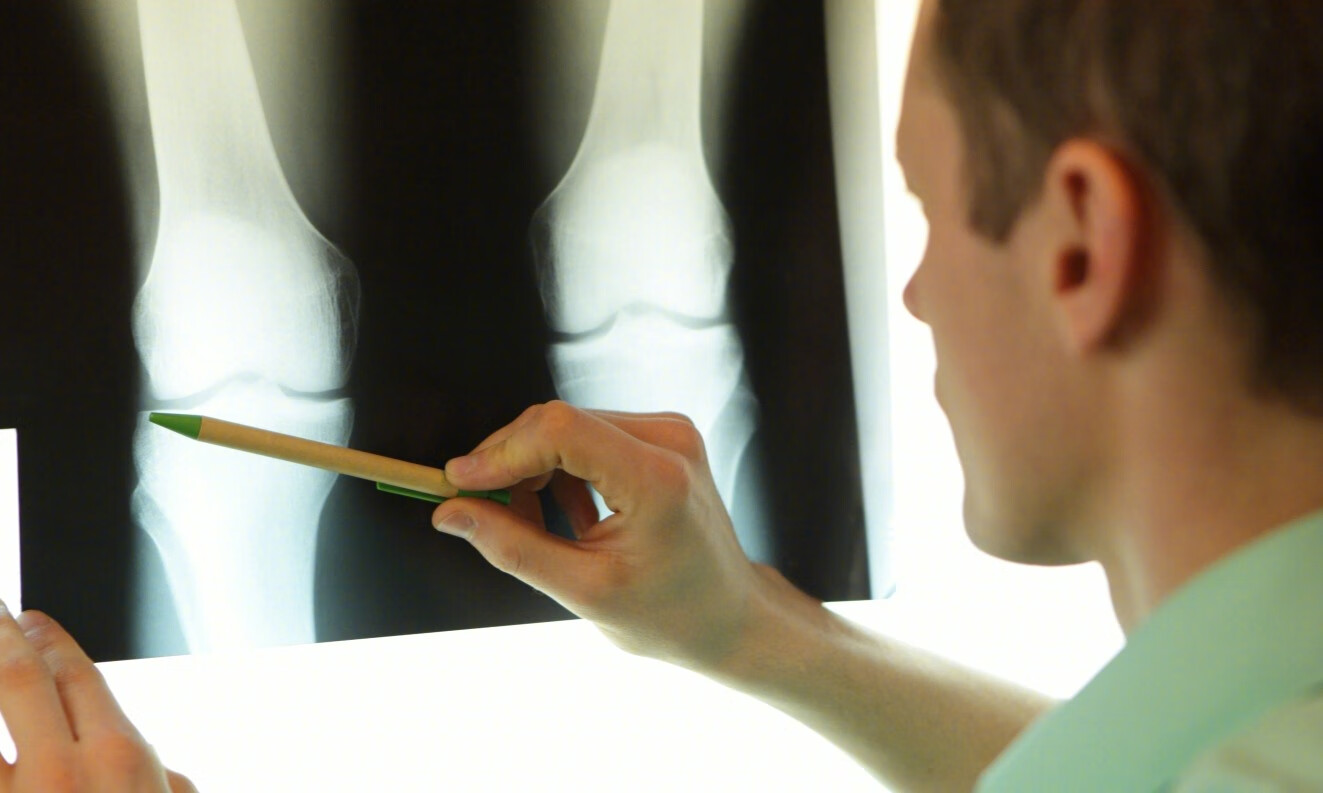 什么是膝关节半月板损伤？这个解释，或能让你了解清楚