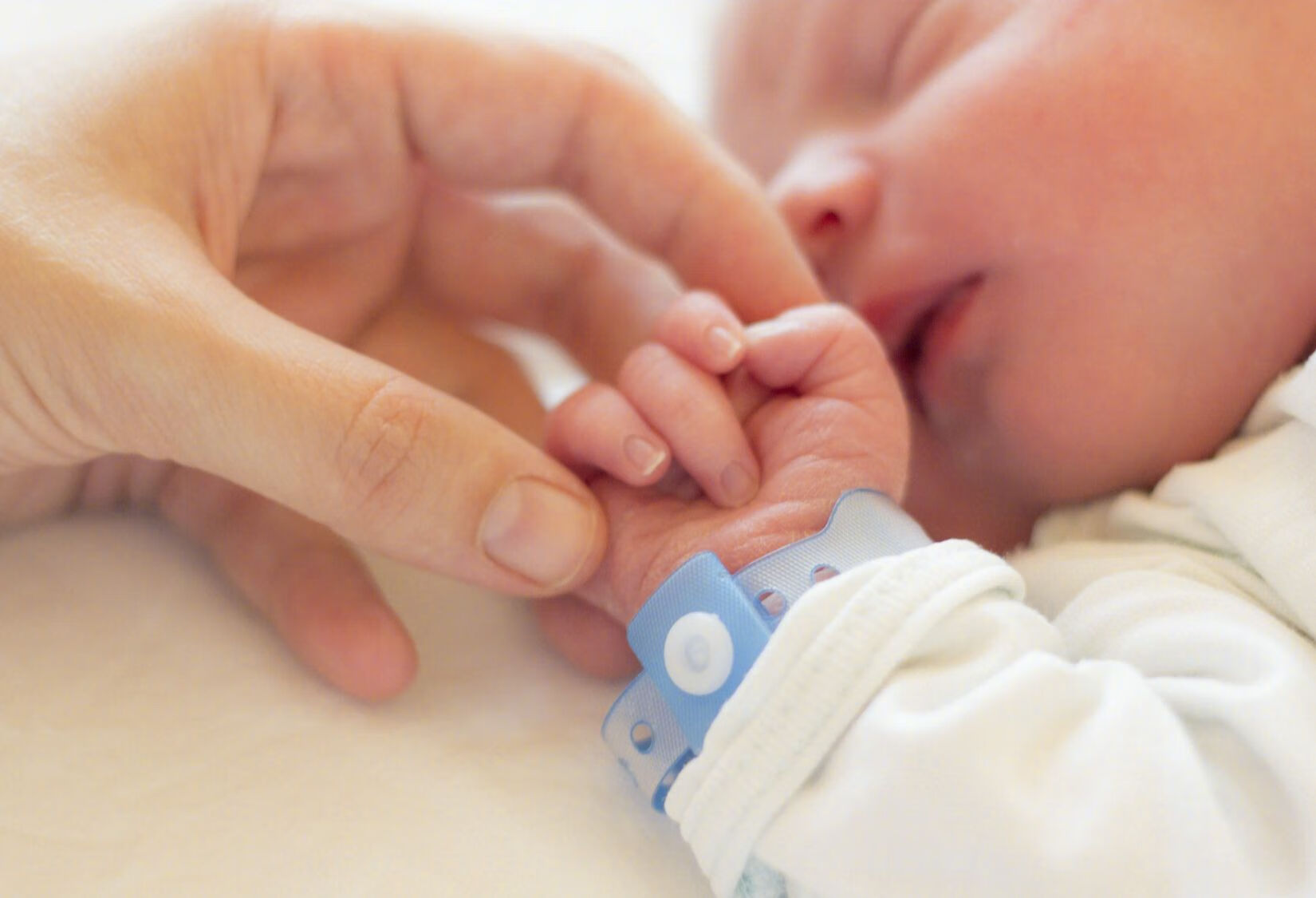 新生儿高胆红素血症的注意事项有哪些？