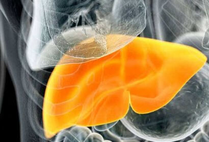研究发现“水果代餐”更容易患脂肪肝？