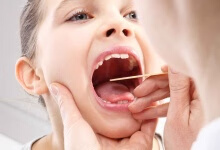 舌头上长黑点是癌症吗 舌头上长黑点的主要原因介绍