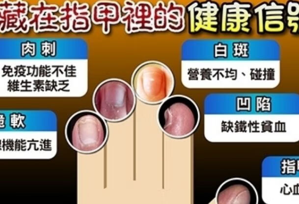 指甲有竖纹，是身体里有着怎样的病理？