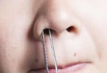 鼻毛的作用是什么？剪掉对身体造成伤害吗？
