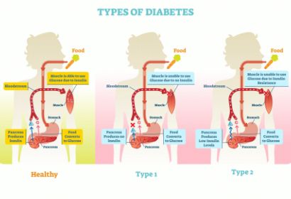 预防糖尿病，九个危险因子莫轻视