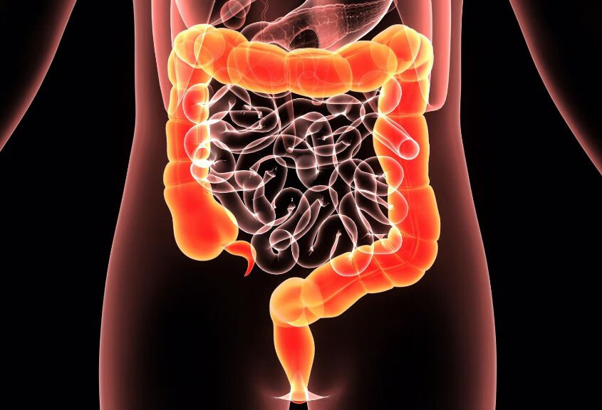 肠梗阻有哪些科学的日常护理措施？