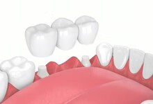 牙龈发炎可以吃阿莫西林吗