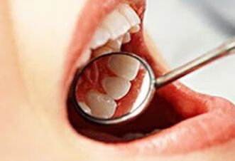 口腔溃疡反复发作怎么办？中医治疗有办法