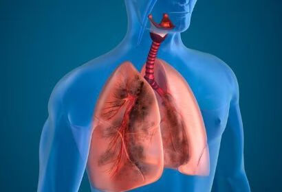 这东西是肺部的“清洁工”，更是支气管炎的死穴