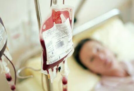 输血有不良反应，严重的可能引起过敏性休克