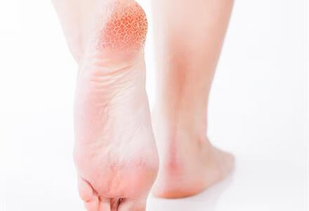 右脚食指疼痛怎么回事？