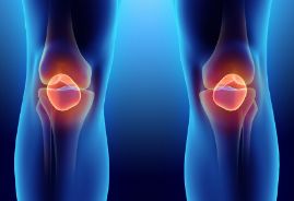 膝盖关节炎是回事？揭秘引发膝盖关节炎6大原因