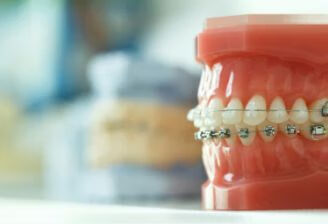 矫正牙齿前要做哪些检查和治疗？