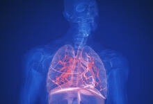 87%肺癌死亡患者因抽烟 肺癌预防注意这些