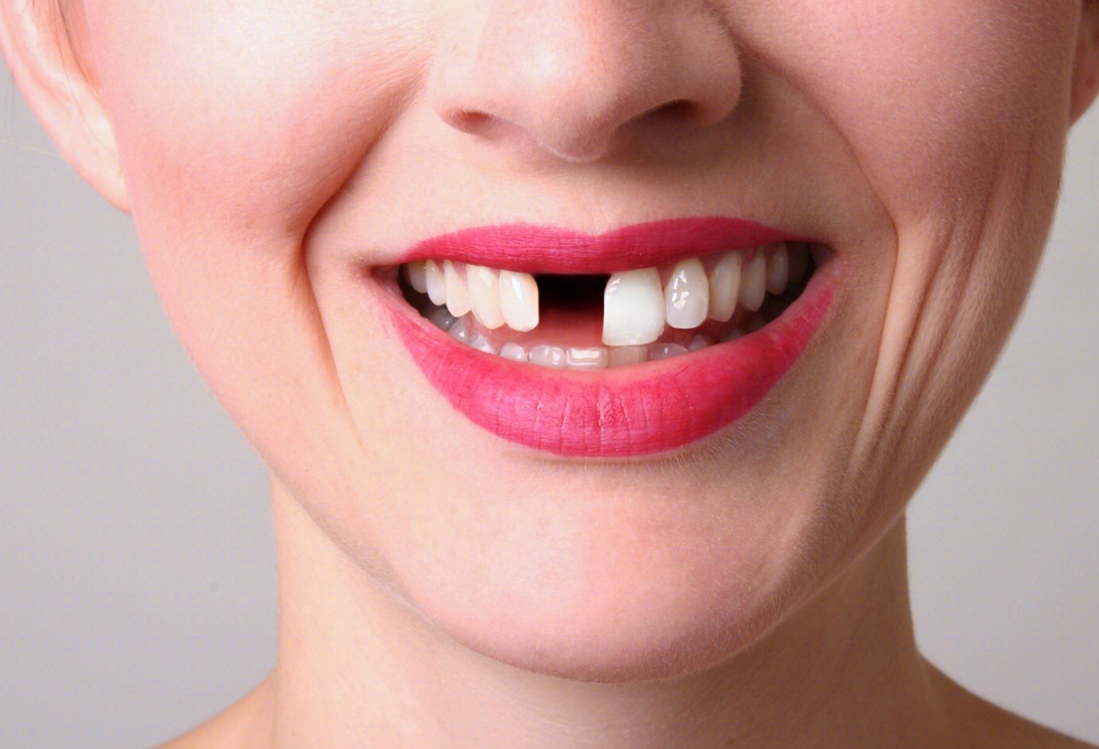 牙齿缺失可以有哪些治疗方式