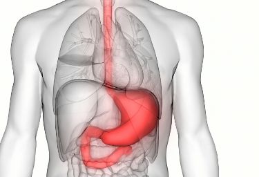 什么是胃石症，该如何预防呢？