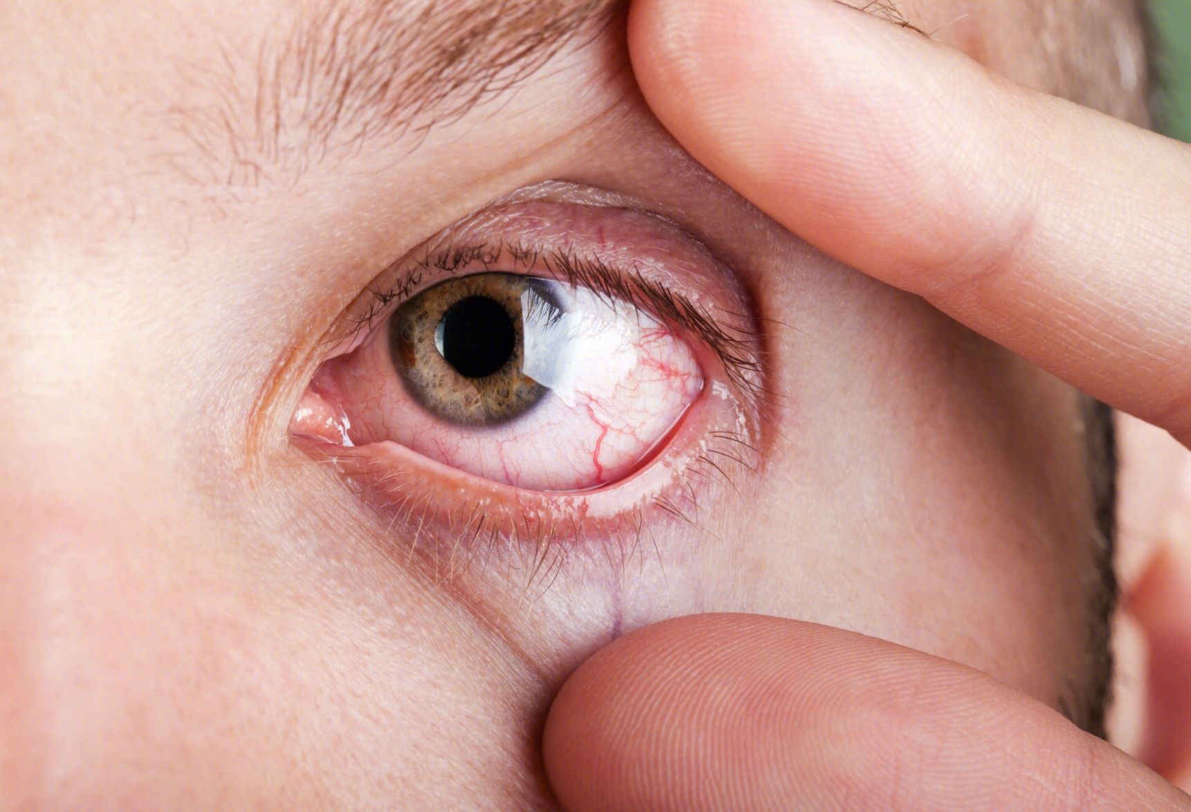 视神经炎都有哪些症状表现呢？