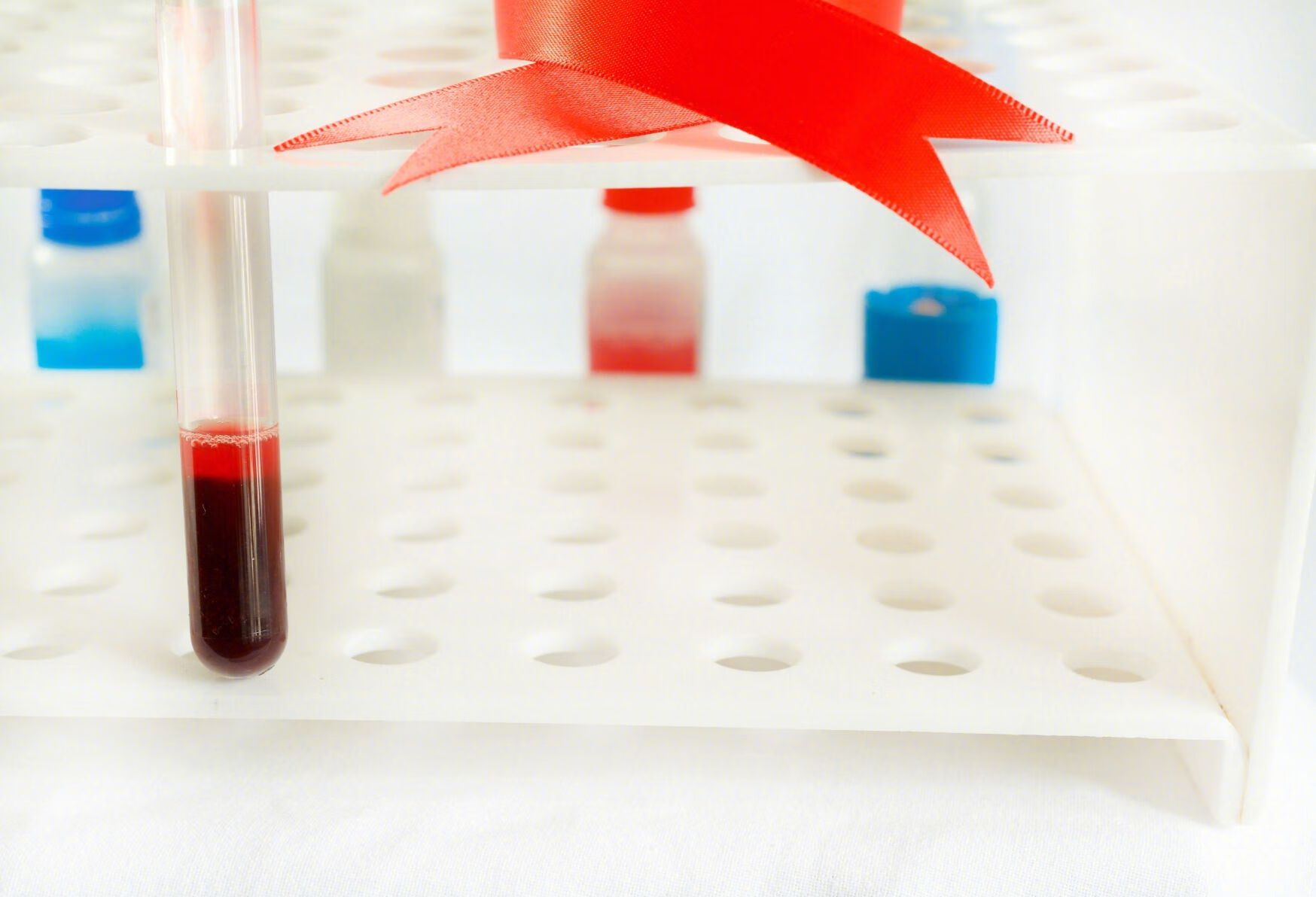 获得性血友病的治疗方式有哪些？
