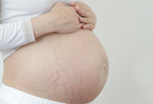 怀孕中晚期出现四肢皮肤瘙痒，怎么回事？