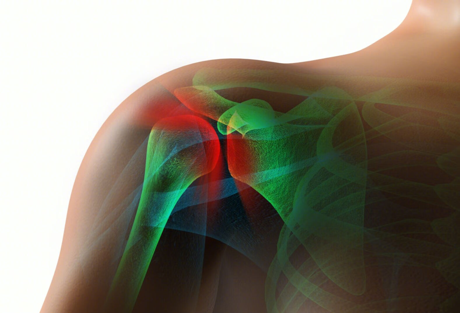 肩周炎的症状表现有哪些？