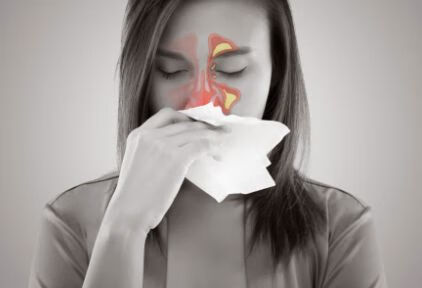 鼻炎反复发作？中医：只需这3招，清鼻通窍，呼吸畅通