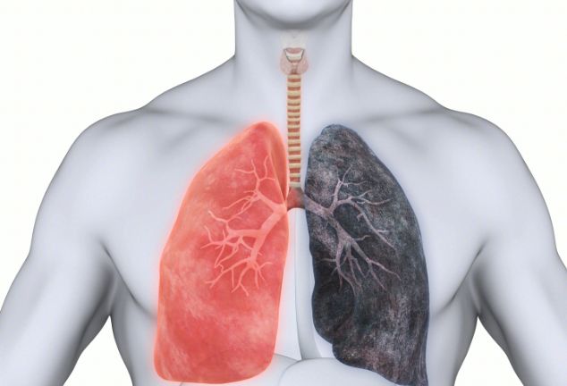 哪些因素会引起肺气肿？