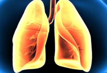 肺癌怎样在早期发现？容易被误诊为哪些疾病？