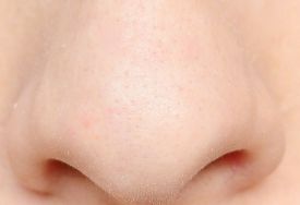 鼻咽癌的症状：鼻咽癌早期四个明显特征