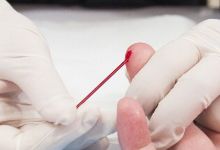 血型竟然会暴露患癌风险？