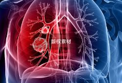 很多人都对肺癌不陌生，发病率增长最快的恶性肿瘤