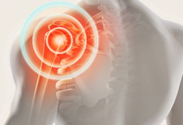 骨质疏松会引起肩周炎吗？