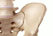 得了骨盆骨折能恢复正常吗？