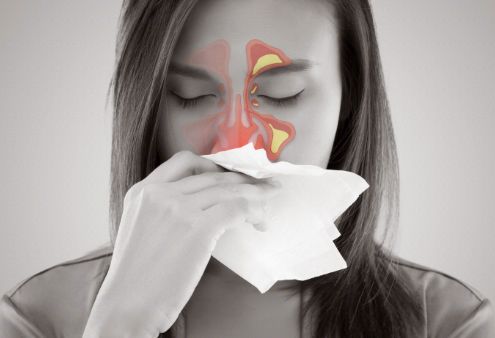 如何避免过敏性鼻炎反复发作？