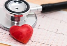 心律失常有哪些护理方法？