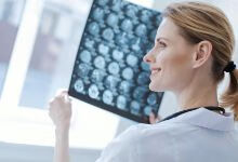 你知道脑膜瘤有什么常见症状吗？