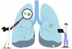 肺纤维化的症状表现有哪些？