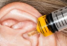 突发性耳聋的治疗方法都有哪些?