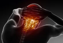 颈椎病该如何避免？它会严重影响你的生活！