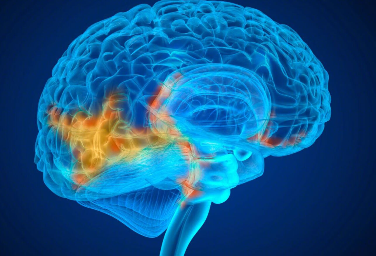 脑钙化和脑萎缩有什么区别？