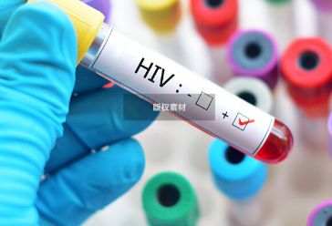 艾滋病会引起免疫力下降吗？