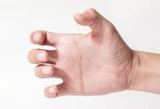 手指发麻恐有「大隐患」！4类异常，一定注意
