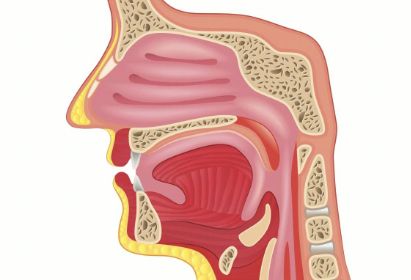 嗓子难受有异物感，会是食道癌吗？