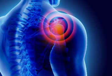 肩周炎3种类型，都有肩膀疼痛抬不起来的症状