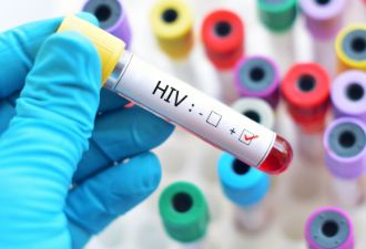 大学生艾滋病患者逐年增多，如何预防艾滋感染？