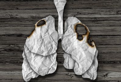 吸烟是导致肺癌的“罪魁祸首”吗？