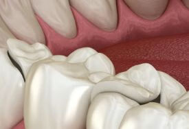﻿如果是牙周炎患者，还能矫正牙齿吗？