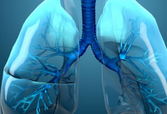 肺部有异物是什么症状？