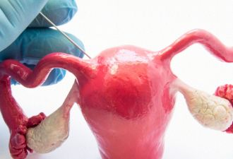 卵巢囊肿，这4大早期症状你中招了吗？