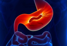 肠痉挛如何快速缓解 快速缓解肠痉挛5方法介绍